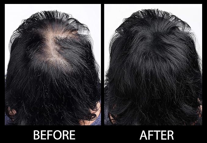 Volumizing Hair Fibers with real Keratin for Thinning Hair/Hair Loss – Dermatologist Tested and Certified Hypoallergenic - 60 days + supply - Multiple Colors Available (Light Brown)